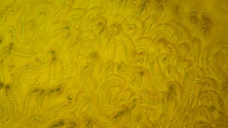 Microscopic view of Nostoc algae.